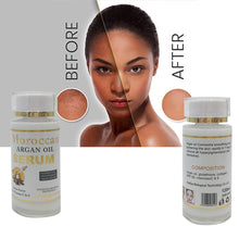 Indlæs billede til gallerivisning Moroccan Argan Oil Serum Lait Brightening Body Serum Concentre Smoothing Lightening Skin Remove Hyperpigmentation and Blemishes
