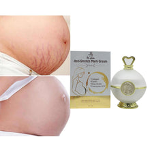 Load image into Gallery viewer, Anti-Stretch Mark Cream Repair Body Stretch Mark Removal Cream Repair Remove Pregnancy Scars Treatment
