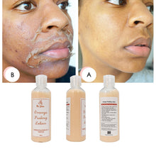 Lade das Bild in den Galerie-Viewer, Dr. Gluta Whitening Peeling Serum for Removing Dead Skin Grow Smooth New Skin Peeling Oil Whitening Remove Dark Spots
