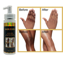 Load image into Gallery viewer, Gluta Master Terminal White Secret Black Skin Knuckles Serum Ultra White for Removing Dark Knuckle Elbow &amp; Knee 200ml

