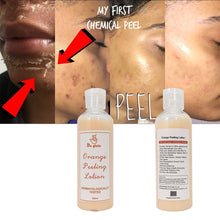 Lade das Bild in den Galerie-Viewer, Dr. Gluta Whitening Peeling Serum for Removing Dead Skin Grow Smooth New Skin Peeling Oil Whitening Remove Dark Spots
