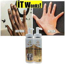 Lade das Bild in den Galerie-Viewer, Dr. Gluta Knuckle Serum Ultra White for Removing Knuckle Elbow Knee Strong Whitening Remove Knuckle Serum 200ML
