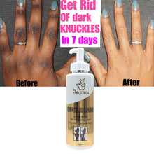 Charger l&#39;image dans la galerie, Dr. gluta Knuckle Lotion Ultra White For Removing Dark Knuckle Elbow &amp; Knee Super Strong Remove Knuckle Whitening Body Lotion

