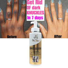 Lade das Bild in den Galerie-Viewer, Dr. gluta Knuckle Lotion Ultra White For Removing Dark Knuckle Elbow &amp; Knee Super Strong Remove Knuckle Whitening Body Lotion

