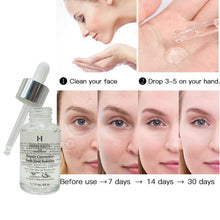 Load image into Gallery viewer, Repair Skin Tone Corrective Dark Spots Solution Serum Brightening Skin with Glycerol Oil Remove Post-acne Marks Oil Serum 50ml

