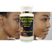 Load image into Gallery viewer, Glutathion Injection Intensif Brightening Serum Remove Dark Spot Pimple Freckle Moisturize Anti-Aging Oxidant
