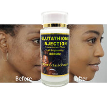 Indlæs billede til gallerivisning Glutathion Injection Intensif Brightening Serum Remove Dark Spot Pimple Freckle Moisturize Anti-Aging Oxidant
