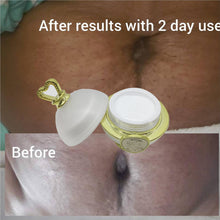 Charger l&#39;image dans la galerie, Dr. Gluta Anti-Stretch Mark Cream Repair Body Stretch Mark Removal Cream Repair Remove Pregnancy Scars Treatment Body Skin Care

