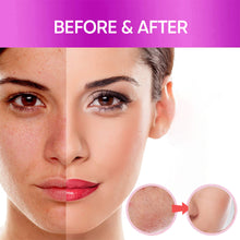 Charger l&#39;image dans la galerie, 5D Gluta Dark Spot Corrector Brightening Serum for Removing Melasma Melanin Hyperpigmentation 120ML Serum
