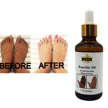 Lade das Bild in den Galerie-Viewer, The Hot Sale Whitening and Moisturizing Kunckle Skin Care Oil Withy Arbutin and Collagen 50ML for Dark Knuckle Elbow  and Knee
