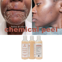 Carica l&#39;immagine nel visualizzatore di Gallery, Whitening Peeling Serum for Removing Dead Skin Grow Smooth New Skin Peeling Oil Whitening Remove Dark Spots
